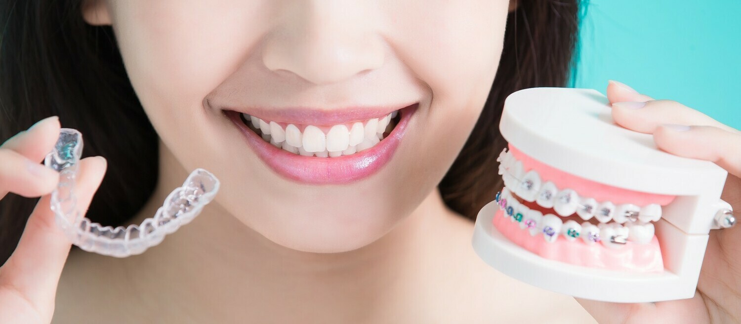 <span style="font-weight: bold;">Ортодонтія</span>